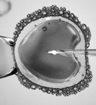 הפריה חוץ גופית